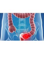 ⁦شيك اوف⁩ - الصورة ⁦3⁩