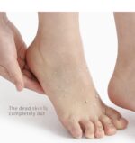 ⁦مقشر القدم الكوري⁩ - الصورة ⁦3⁩